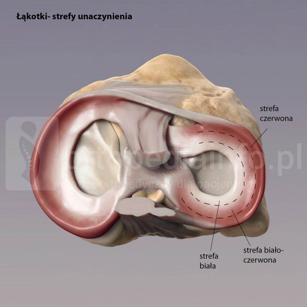 uszkodzenie łąkotki - strefy unaczynienia łąkotki